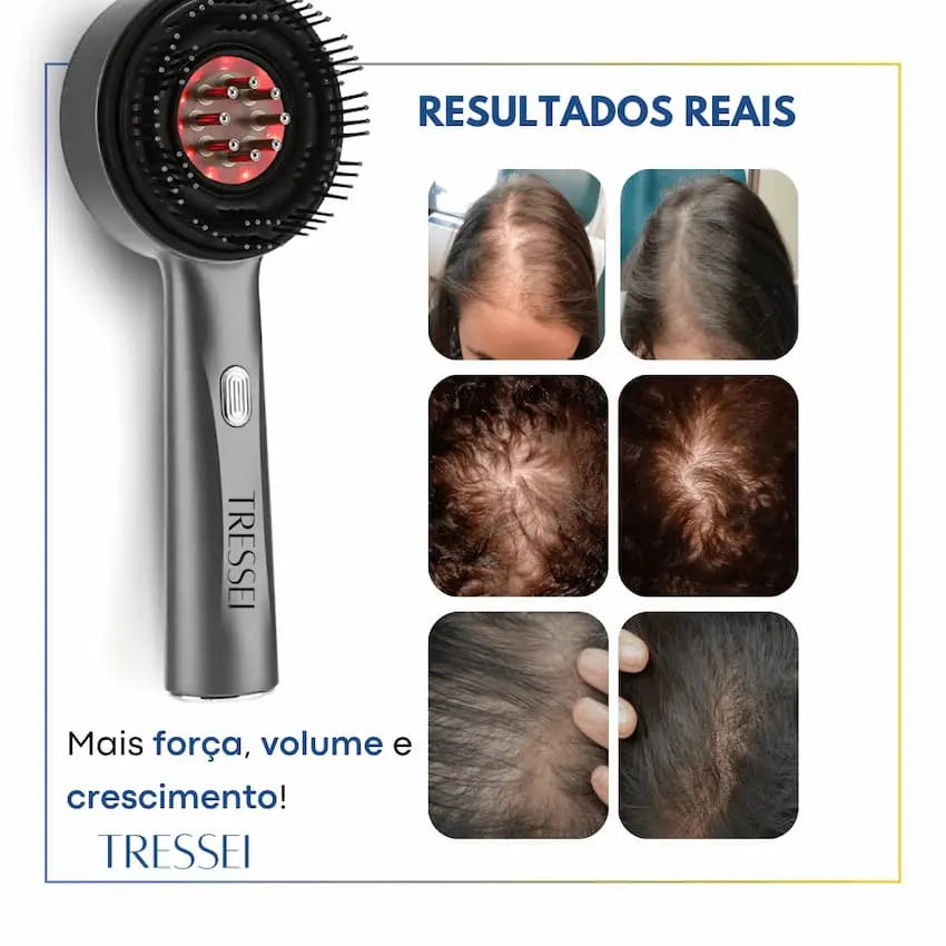 Escova Massageadora Capilar + Kit Crescimento Capilar Completo